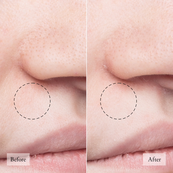 Ulta Philosophy  Purity Made Simple Pore Extractor Exfoliating Clay Mask