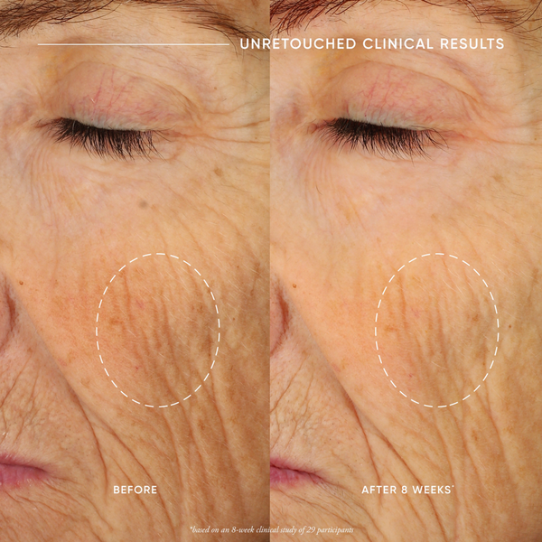 Ulta Philosophy  Ultimate Miracle Worker Nourish & Rejuvenate Face & Neck Cream