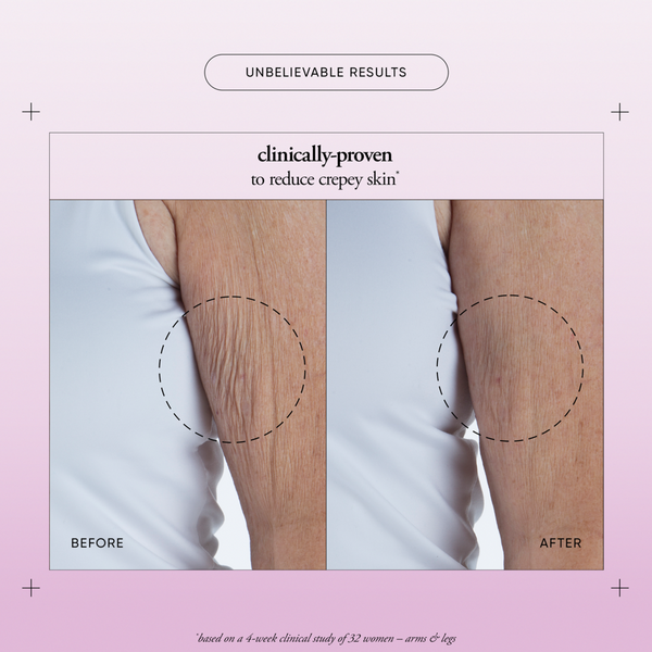 Ulta Philosophy  Ultimate Miracle Worker Resurfacing Body Serum