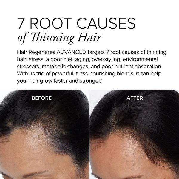 Ulta SeroVital  Hair Regeneres Advanced Dietary Supplement