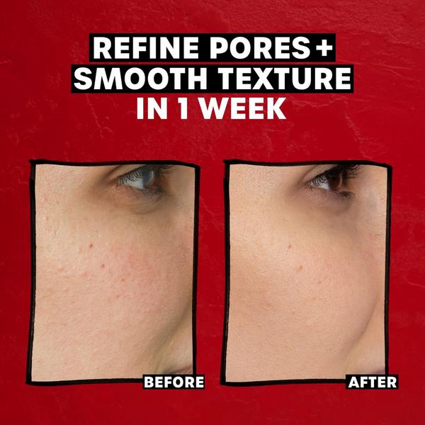 Ulta Thayers  2% AHA Exfoliating Smoothing And Pore Refining Toner