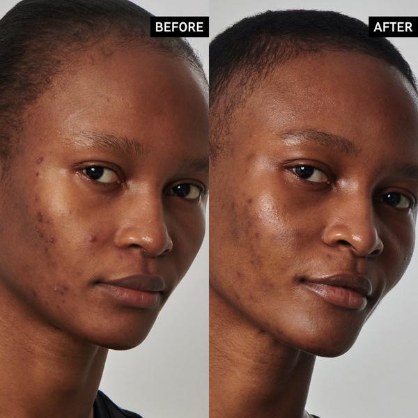 Ulta The INKEY List  SuperSolutions 20% Niacinamide Serum