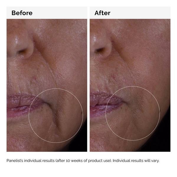 Ulta The Ordinary  GF 15% Serum For Visible Skin Repair And Wrinkles