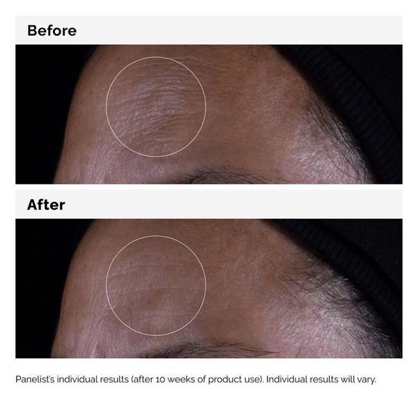 Ulta The Ordinary  GF 15% Serum For Visible Skin Repair And Wrinkles