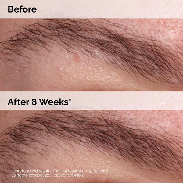 Ulta The Ordinary  Multi-Peptide Lash And Brow Serum For Thicker Fuller Looking Lashes & Brows