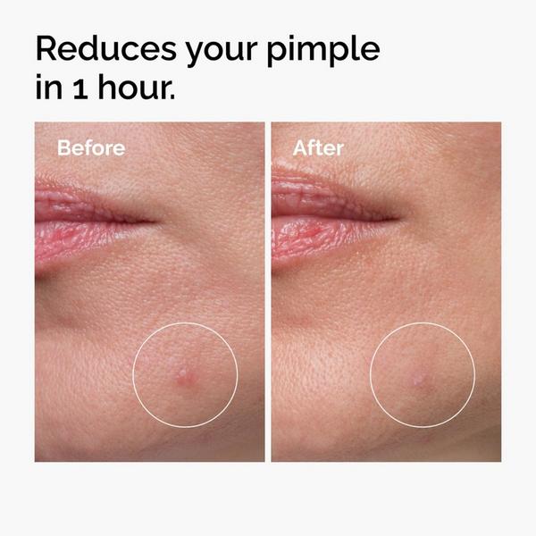 Ulta The Ordinary  Sulfur 10% Powder-to-Cream Concentrate