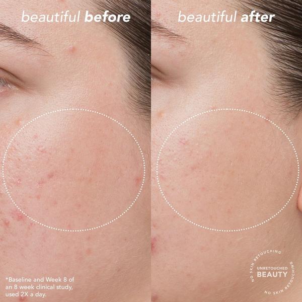 Ulta TULA  Bright Start Vitamin C Antioxidant Brightening Moisturizer