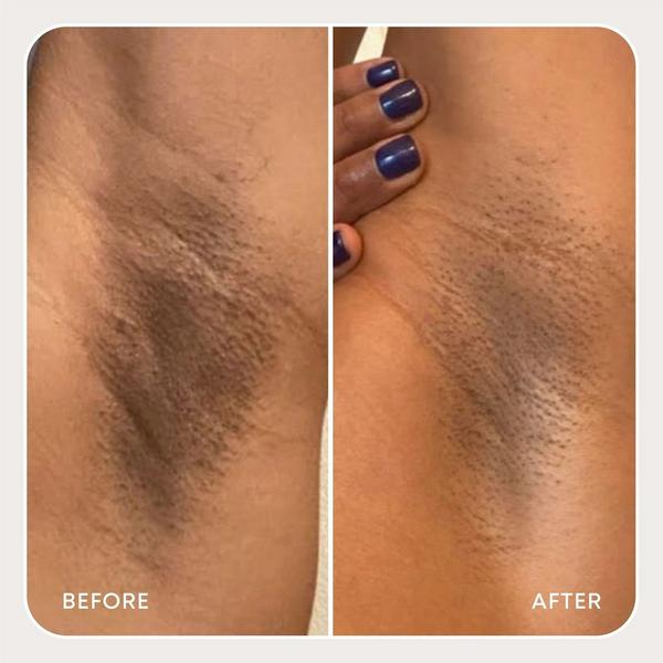 Ulta Bushbalm  Dark Spot Oil