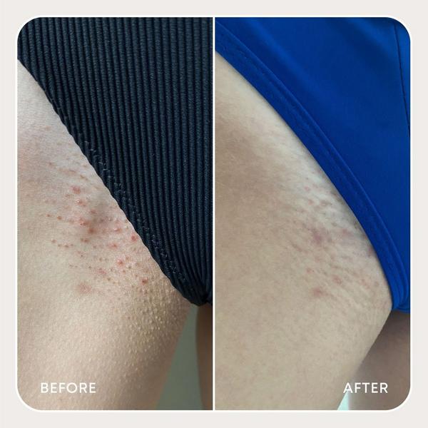 Ulta Bushbalm  Ingrown Hair Oil