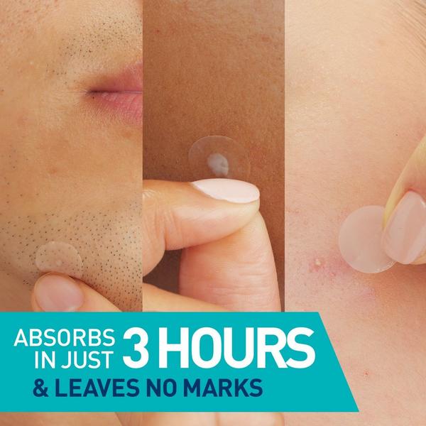 Ulta CeraVe  Blemish Barrier Patches