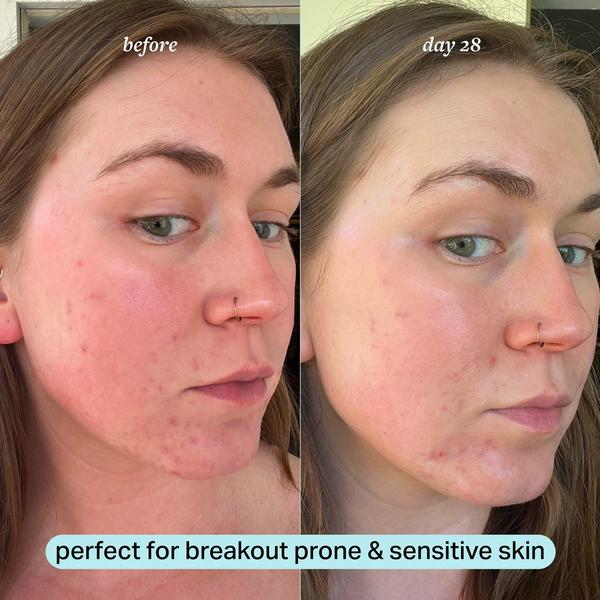 Ulta Cocokind  Calming Magnesium Facial Mist