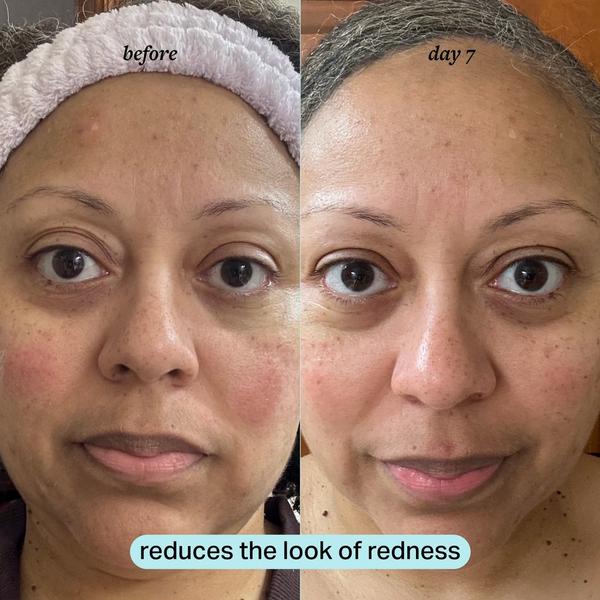 Ulta Cocokind  Calming Magnesium Facial Mist