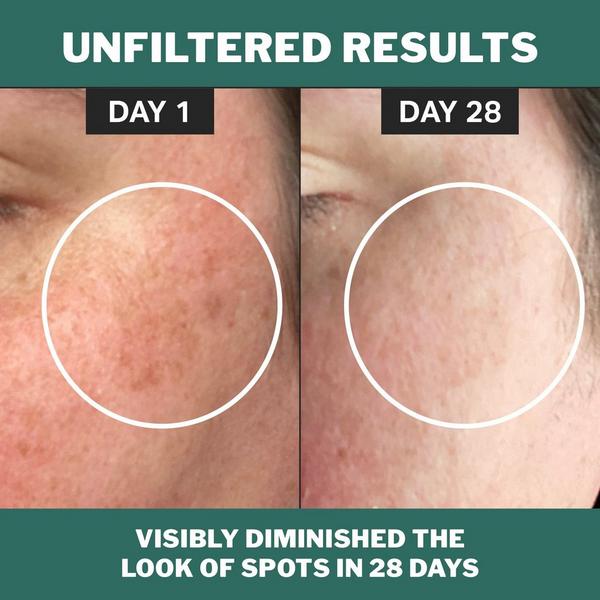 Ulta Cocokind  Chlorophyll Discoloration Serum