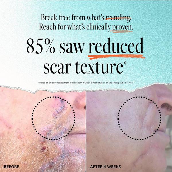 Ulta DERMA E  Scar Gel With Pathenol And Allantoin