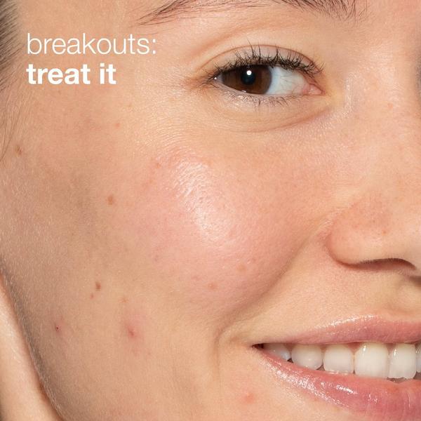 Ulta Dermalogica  Clear And Brighten Skincare Kit