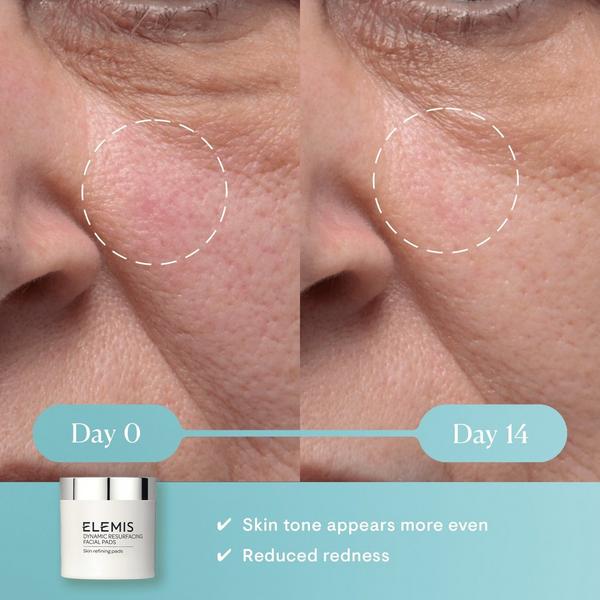Ulta ELEMIS  Dynamic Resurfacing Facial Pads