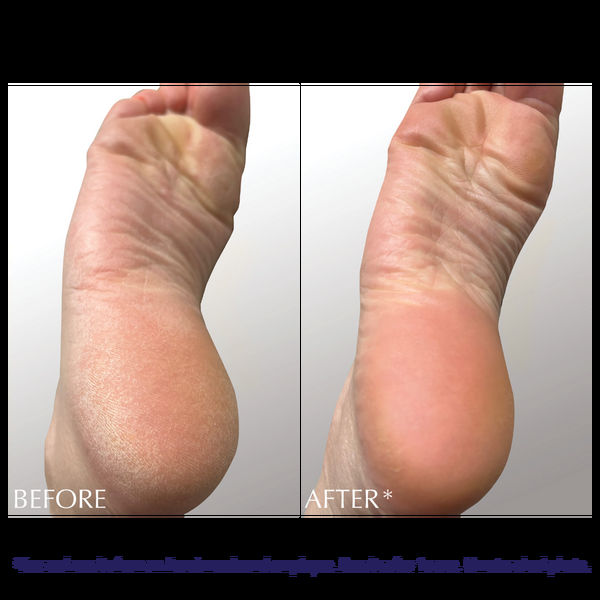 Ulta Exuviance  Exfoliating & Conditioning Foot Balm