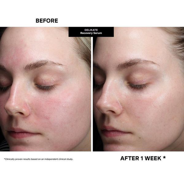 Ulta Kate Somerville  DeliKate Recovery Serum
