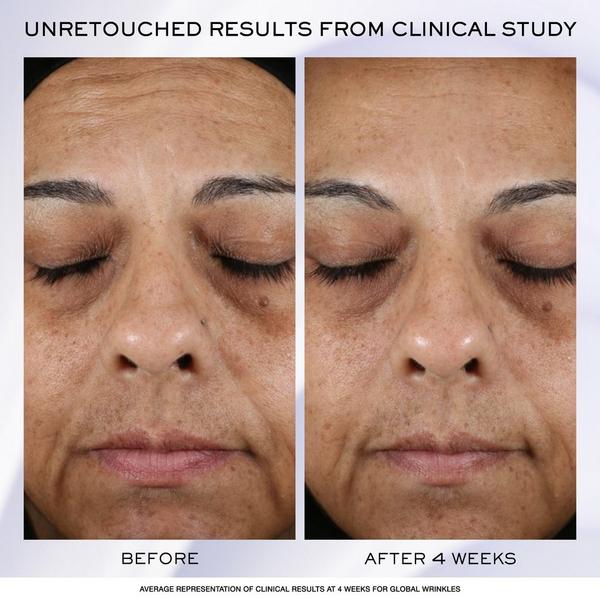 Ulta Lancôme  Rénergie H.P.N. 300-Peptide Cream