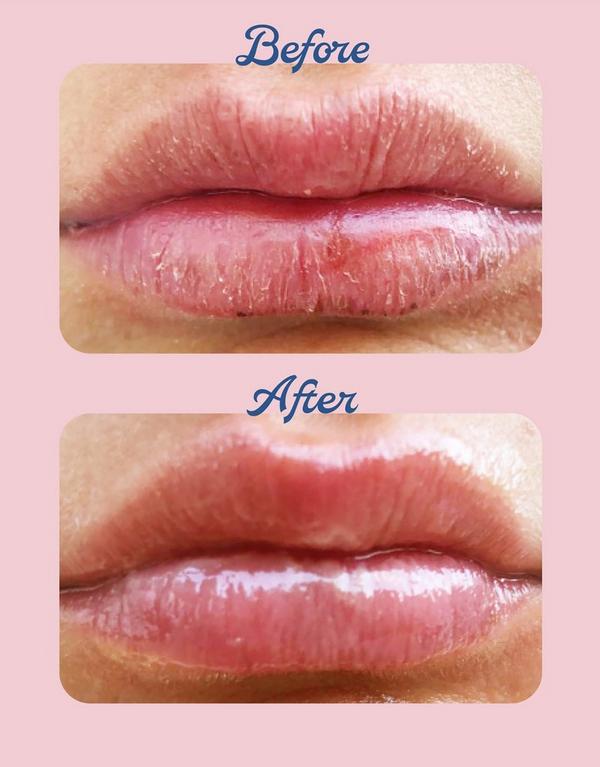 Ulta Lanolips  Minty 101 Ointment Balm