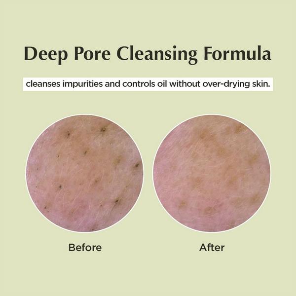 Ulta Ma:nyo  Deep Pore Cleansing Soda Foam