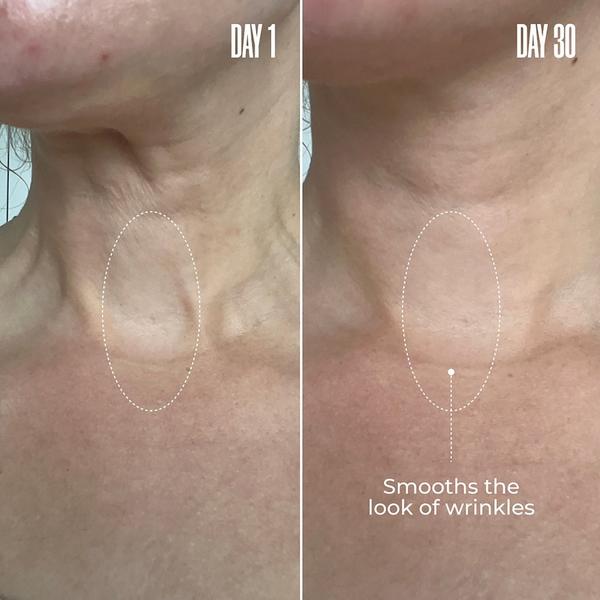 Ulta MAËLYS  B-POISED Neck & Décolleté Firming Cream