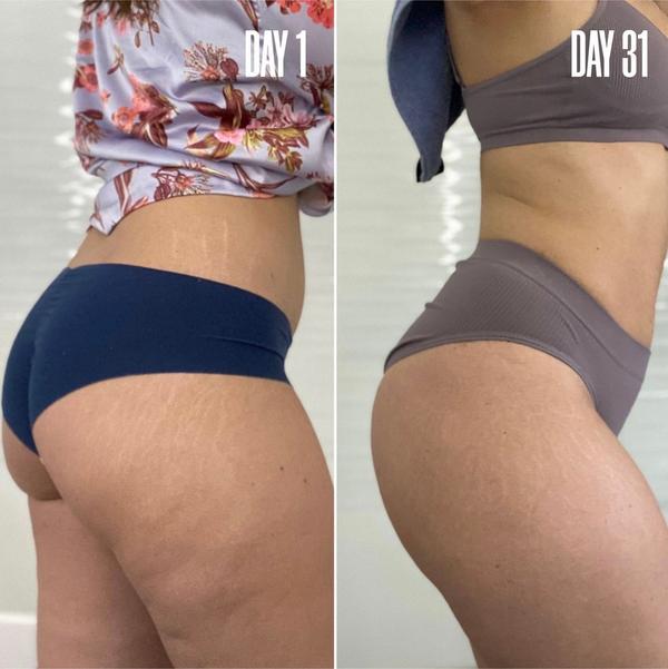 Ulta MAËLYS  GET-SPRUNG Enriched Stretch Mark Oil