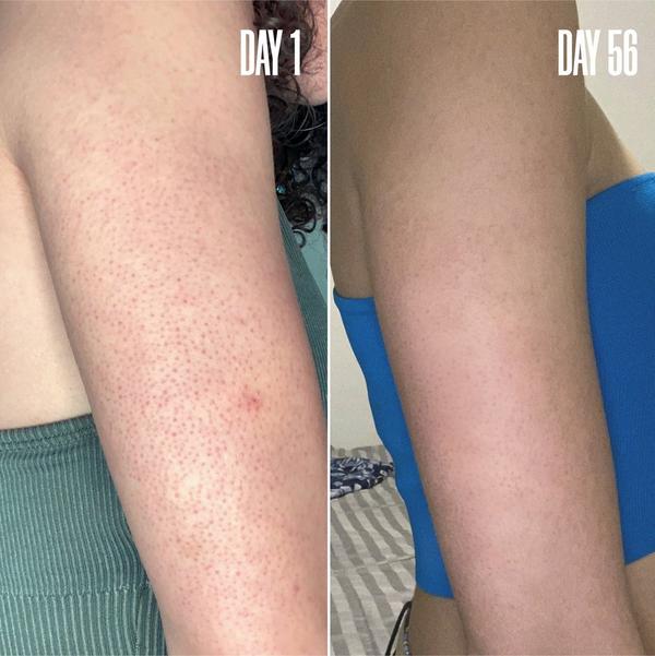 Ulta MAËLYS  RE-START Resurfacing Body Serum