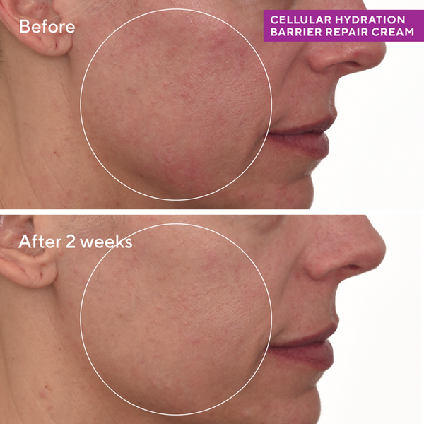 Ulta Murad  Cellular Hydration Barrier Repair Cream