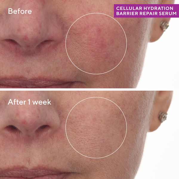 Ulta Murad  Cellular Hydration Barrier Repair Serum