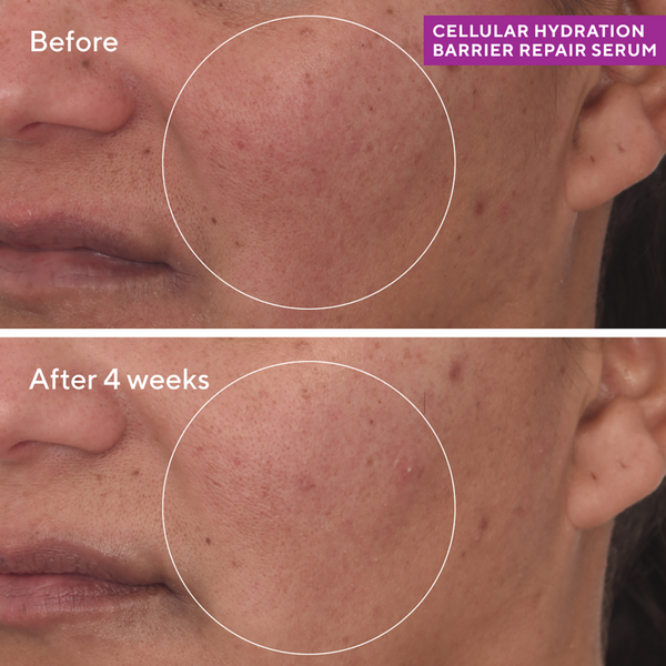 Ulta Murad  Cellular Hydration Barrier Repair Serum