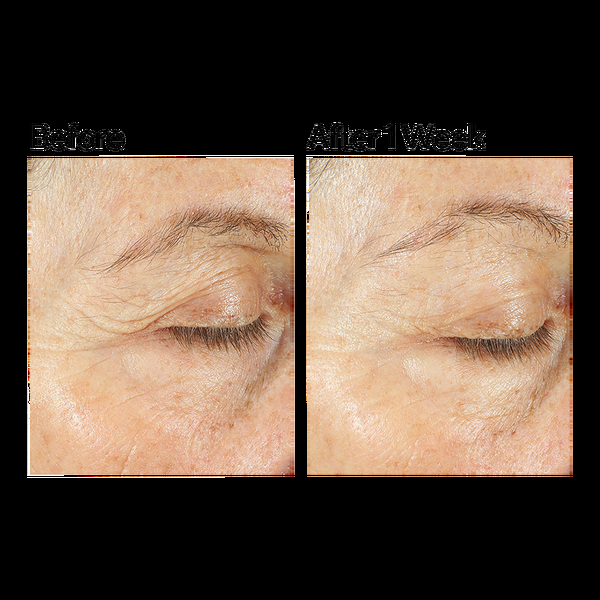 Ulta Murad  Hydration Intense Recovery Cream