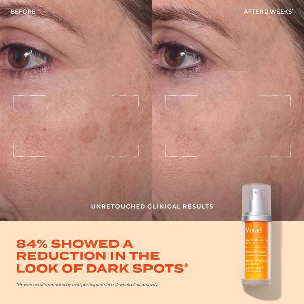 Ulta Murad  Rapid Dark Spot Correcting Serum