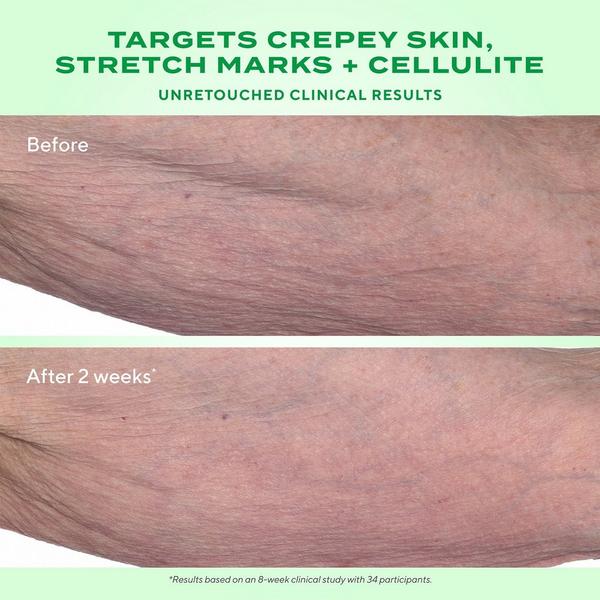 Ulta Murad  Retinal ReSculpt Body Lift Treatment