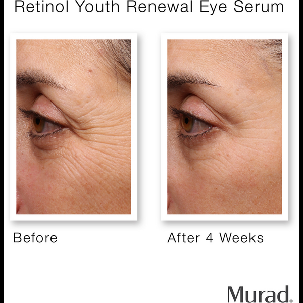 Ulta Murad  Retinol Youth Renewal Eye Serum