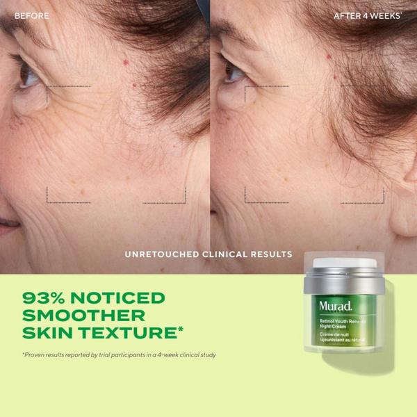 Ulta Murad  Retinol Youth Renewal Night Cream