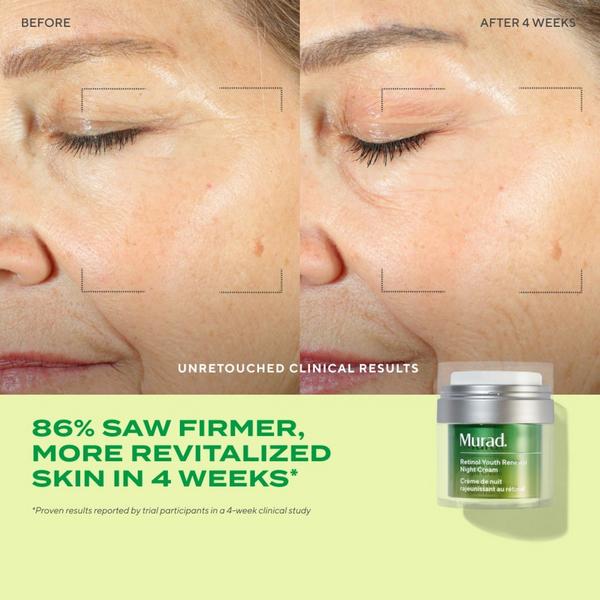 Ulta Murad  Retinol Youth Renewal Night Cream