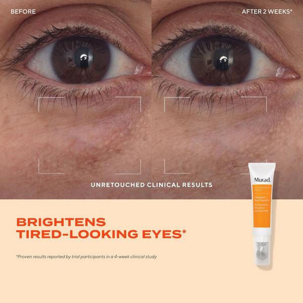 Ulta Murad  Targeted Eye Depuffer