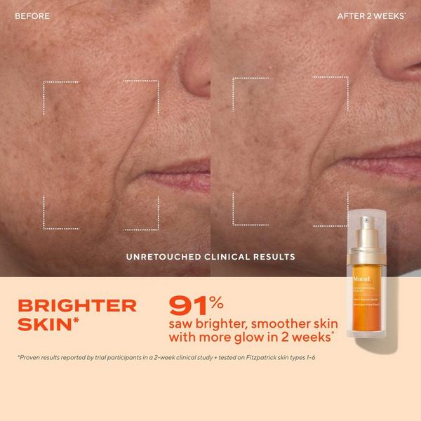 Ulta Murad  Vita-C Glycolic Serum