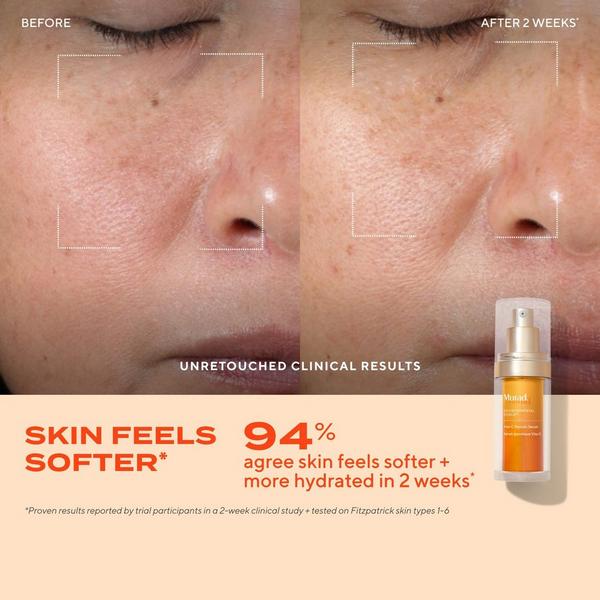 Ulta Murad  Vita-C Glycolic Serum