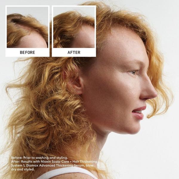 Ulta Nioxin Scalp + Hair Thickening System 1 Kit