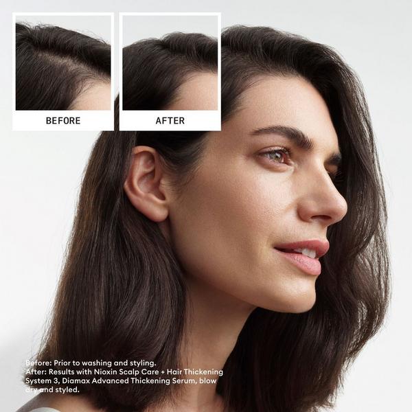 Ulta Nioxin Scalp + Hair Thickening System 3 Kit
