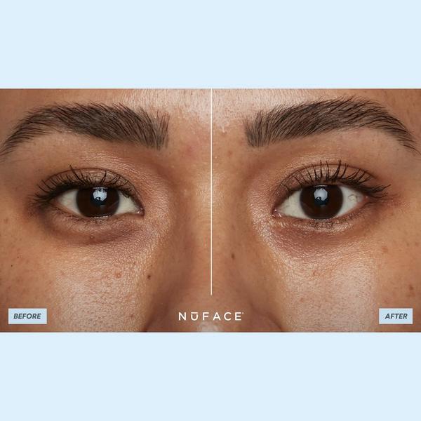 Ulta NuFACE  IonPlex Hydra-Gel Power Patches