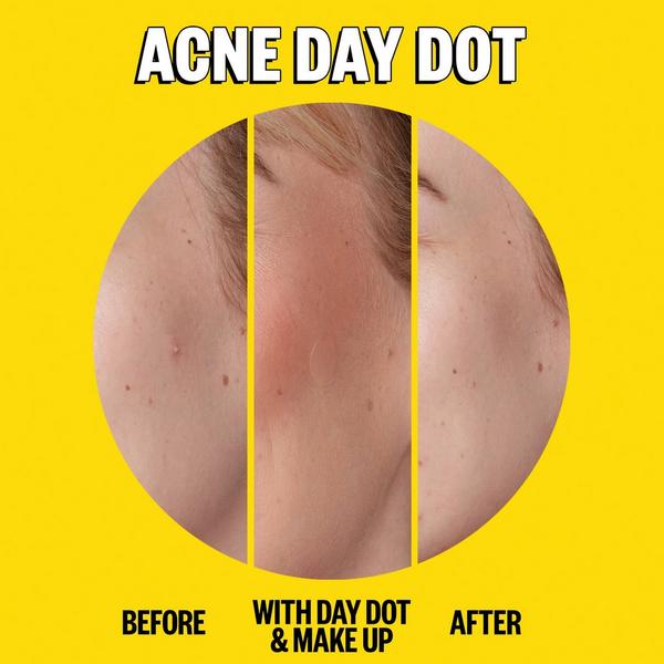 Ulta Peace Out  Salicylic Acid Day & Night Duo