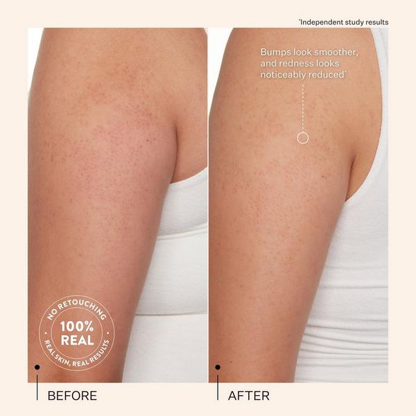 Ulta PEACH & LILY  KP Bump Boss Smoothing Body Lotion