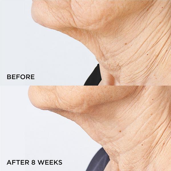 Ulta Perricone MD  Cold Plasma Plus+ Sub-D Neck Duo