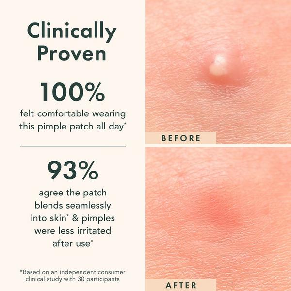 Ulta Rael  Miracle Patch Invisible Spot Cover