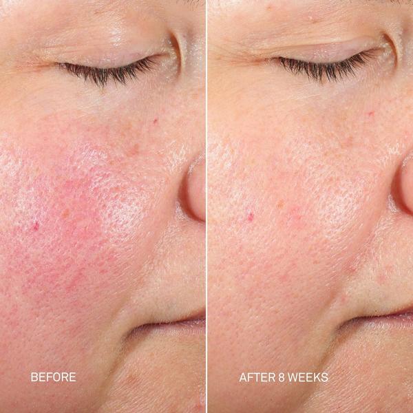 Ulta RescueMD  DNA Repair Complex