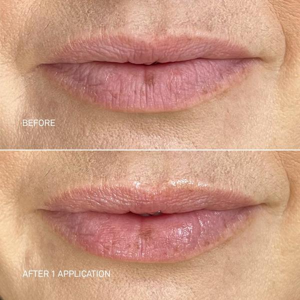 Ulta RescueMD  Restorative Lip Treatment