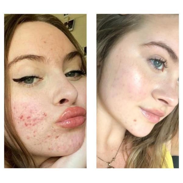 Ulta ROSEN  Bright Citrus Serum For Dark Spots